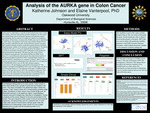 Analysis of the AURKA gene in Colon Cancer​